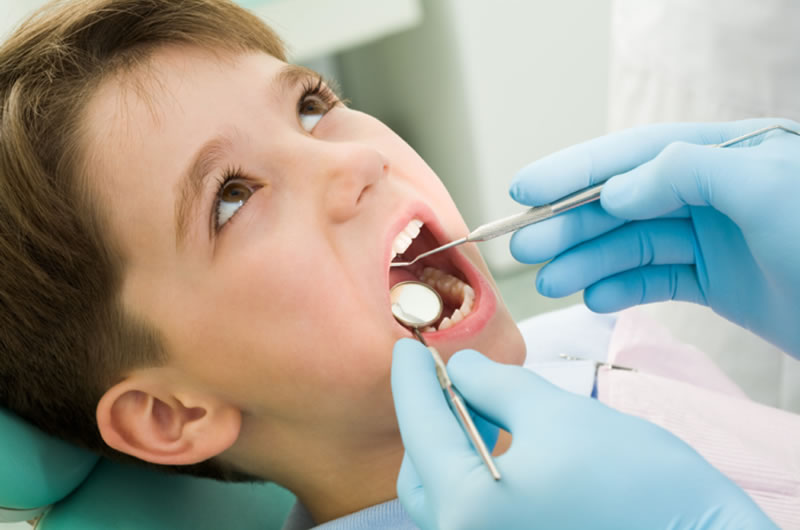 Dental Sealants Dental Sealants